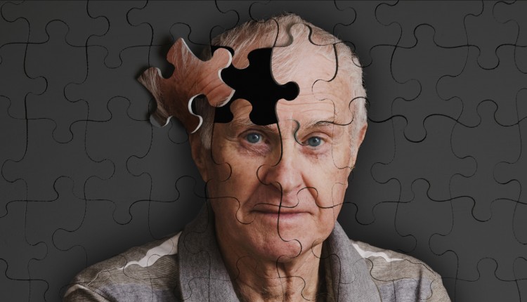 آلزایمر بر غول های صنعت داروسازی غلبه کرد