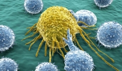 درمان جدید سرطان با تقویت و تحریک سیستم ایمنی