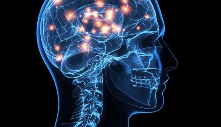 ۲۰ درصد مبتلایان به سکته مغزی به جراحی نیاز دارند