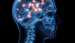 بیماران مبتلا به سکته مغزی نیاز به حمایت دارند