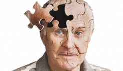 داروهای ضدصرع ریسک زوال عقل و آلزایمر را افزایش می دهد