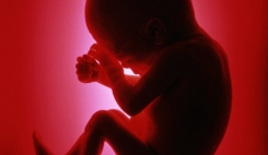 تالاسمی ماژور در فهرست سقط درمانی قانونی قرار دارد