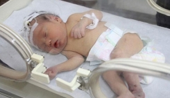 سالانه ۱۲۰ هزار نوزاد نارس در کشور متولد می‌شوند