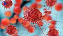 ایمنوتراپی انقلابی در زمینه درمان سرطان است