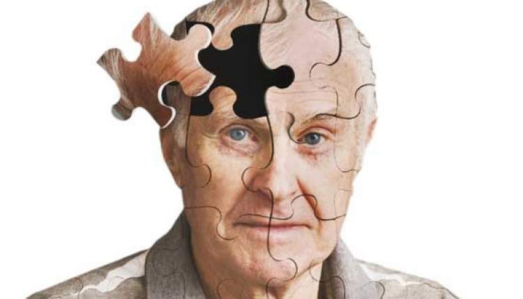 ادعای درمان آلزایمر با مصرف آسپرین