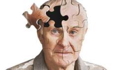 ادعای درمان آلزایمر با مصرف آسپرین