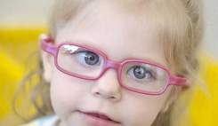 سنین غربالگری تنبلی چشم در کودکان