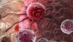 توقف رشد سلول سرطانی با کمپلکس نانودارویی ساخت کشور