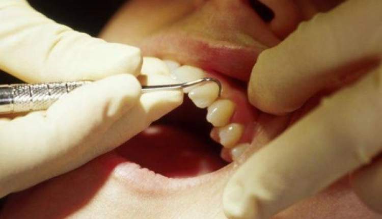 عفونتی خطرناک که در دندان هایتان نهفته است