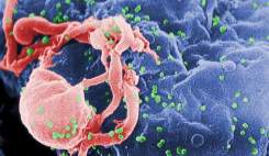 کشف پروتئین مقابله کننده با ابولا در سلول های انسانی