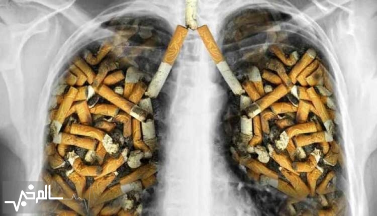 95 درصد از علل بروز بیماری های ریوی در کشور مصرف سیگار است