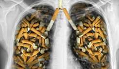 95 درصد از علل بروز بیماری های ریوی در کشور مصرف سیگار است