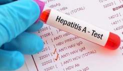 افزایش ۳۰۰ درصدی مبتلایان به هپاتیت A در آمریکا