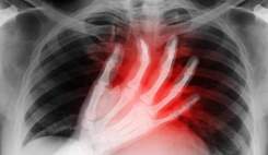 افزایش مرگ ناشی از نارسایی قلبی در آمریکایی‌های زیر ۶۵ سال