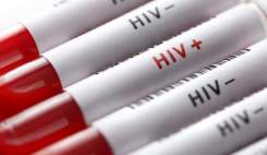 یک آزمایش امیدبخش برای مقابله با ویروس ایدز