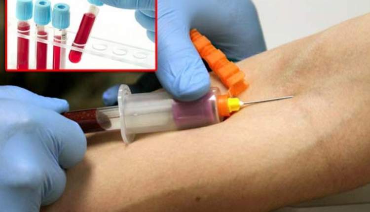 آزمایش خونی که احتمال مرگ را پیش‌بینی می‌کند