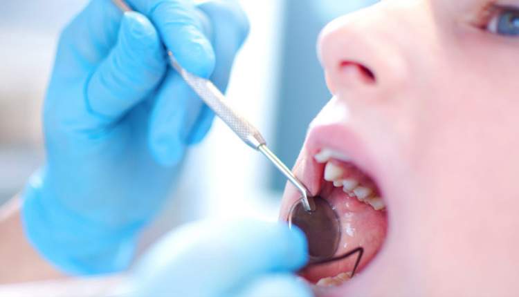 تشخیص به موقع سرطان دهان در سایه توجه دندانپزشكان