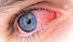 مراقب عفونت های ویروسی چشمی باشید