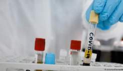 حمایت از ۱۰ شرکت تولیدکننده واکسن برای ساخت واکسن کرونا