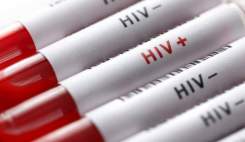 هزینه ۸ میلیارد و ۲۰۰ میلیون تومانی بیمه سلامت برای آزمایش ایدز