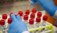 تست غربالگری ژنتیکی ویروس کرونای انگلیسی درآزمایشگاه‌های مرجع