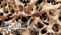 سالانه ۴۲۰۰ ایرانی به خاطر پوکی استخوان فوت می کنند