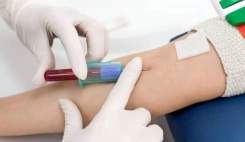دستیابی به یک نوع آزمایش خون با قابلیت تشخیص ده‌ها نوع سرطان