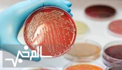 هشدار آمریکا در مورد شیوع باکتری اشریشیا کلی