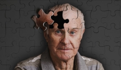 آلزایمر بر غول های صنعت داروسازی غلبه کرد