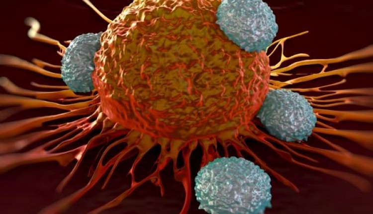 ساخت زیست‌حسگر تشخیص زودهنگام سرطان تخمدان