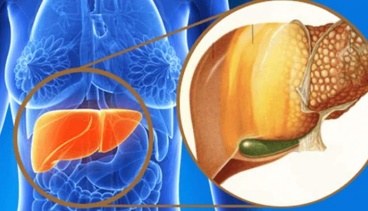 کبد چرب بیماری خاموش و بدون درمان دارویی
