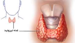 ارتباط بیماری تیروئید با ناباروری