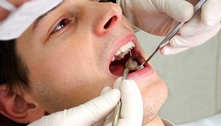 وضعیت اسفبار سلامت دهان و دندان ایرانی ها