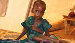 یونیسف: یک سوم کودکان جهان از سوءتغذیه یا اضافه وزن رنج می‌برند