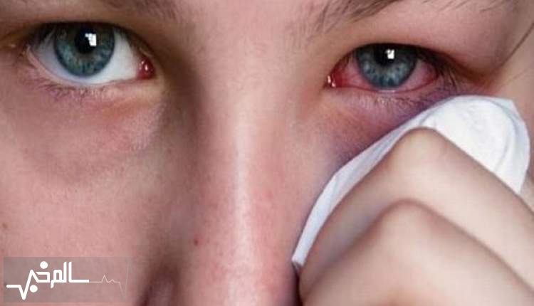 عوارض چشمی کورتیکو استروئیدهای سیستمیک و موضعی را جدی بگیرید
