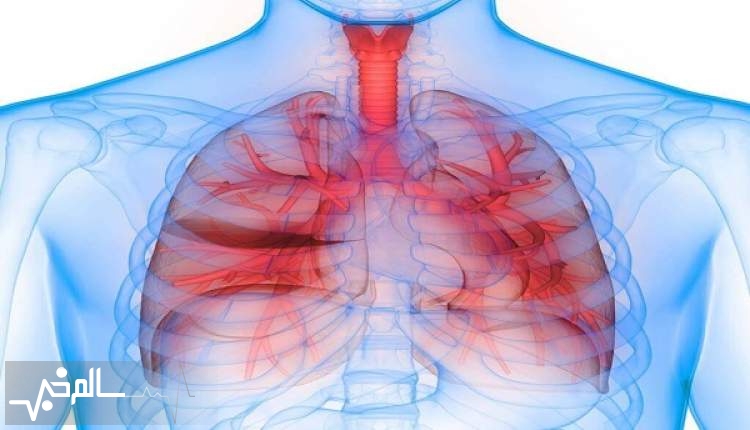 بیماری مزمن انسدادی ریه در زنان شدیدتر است