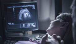 غربالگری در دوران بارداری امر پذیرفته علمی و جهانی است