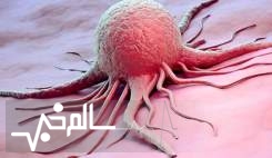 سالانه ۱۵۰ هزار نفر در ایران به سرطان مبتلا می‌شوند