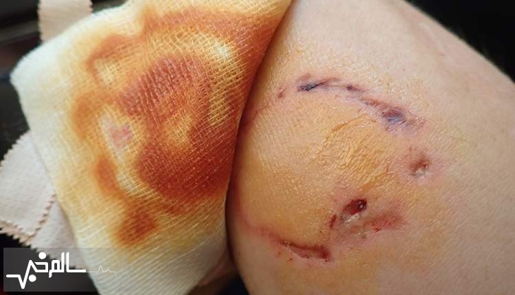 سال گذشته 14 مورد به دلیل سگ‌گزیدگی در کشور هار شدند