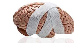 درمان‌های بیمار سکته مغزی محدود به دارو نیست