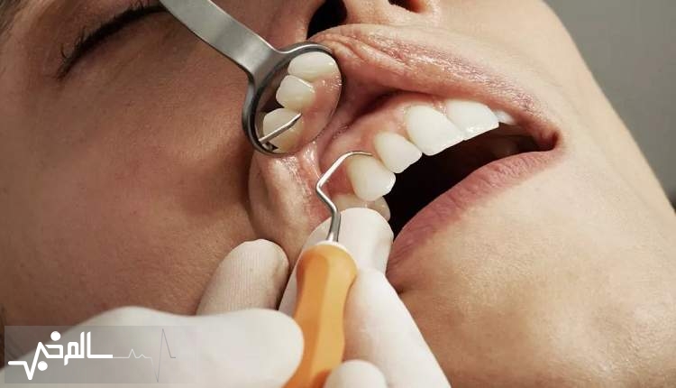 50 درصد مردم ایران از بیماری های دهان و دندان رنج می برند