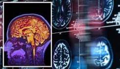 سن ابتلا به آلزایمر در کشور به 49 سال رسیده است