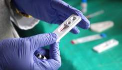 شناسایی نزدیک به 25 هزار مبتلا به HIV در کشور؛ روابط جنسی نخستین عامل انتقال!