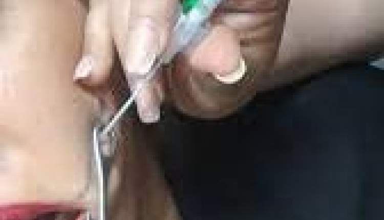 هشدار وزارت بهداشت؛ تتو و پرسینگ مسیر تازه انتقال HIV و هپاتیت
