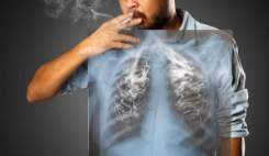 سرطان ریه همچنان مرگبارترین سرطان؛ ۲۰ درصد از مبتلایان هرگز سیگار نکشیده‌اند