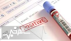 ۴۰ میلیون نفر در جهان با HIV زندگی می کنند